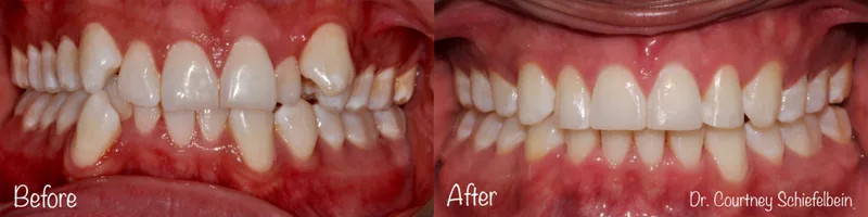 Photo of Dr. Courtney Audra Schiefelbein, DMD